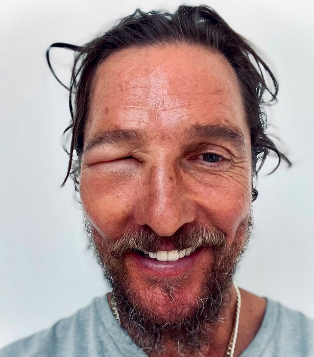 Matthew McConaughey